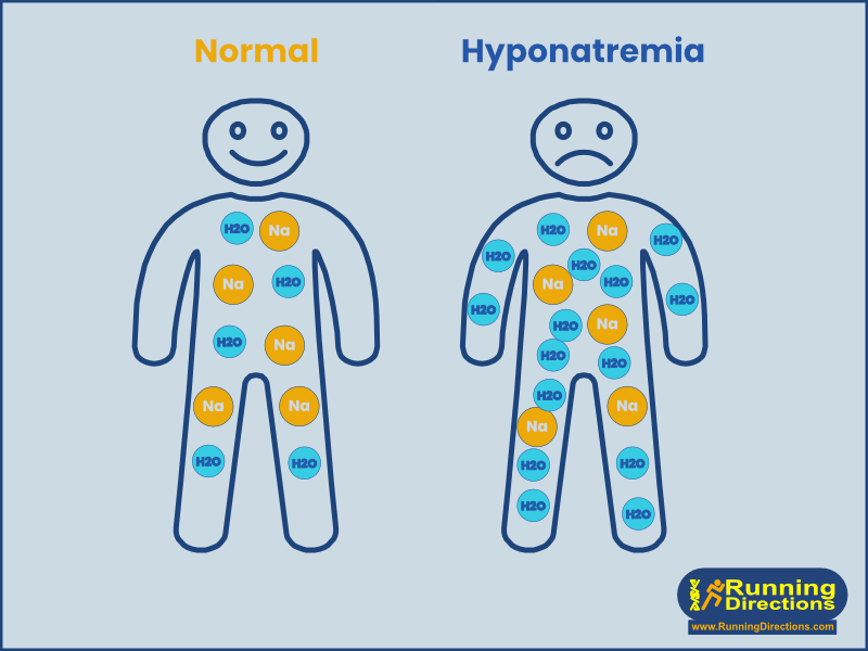 Hyponatremia2